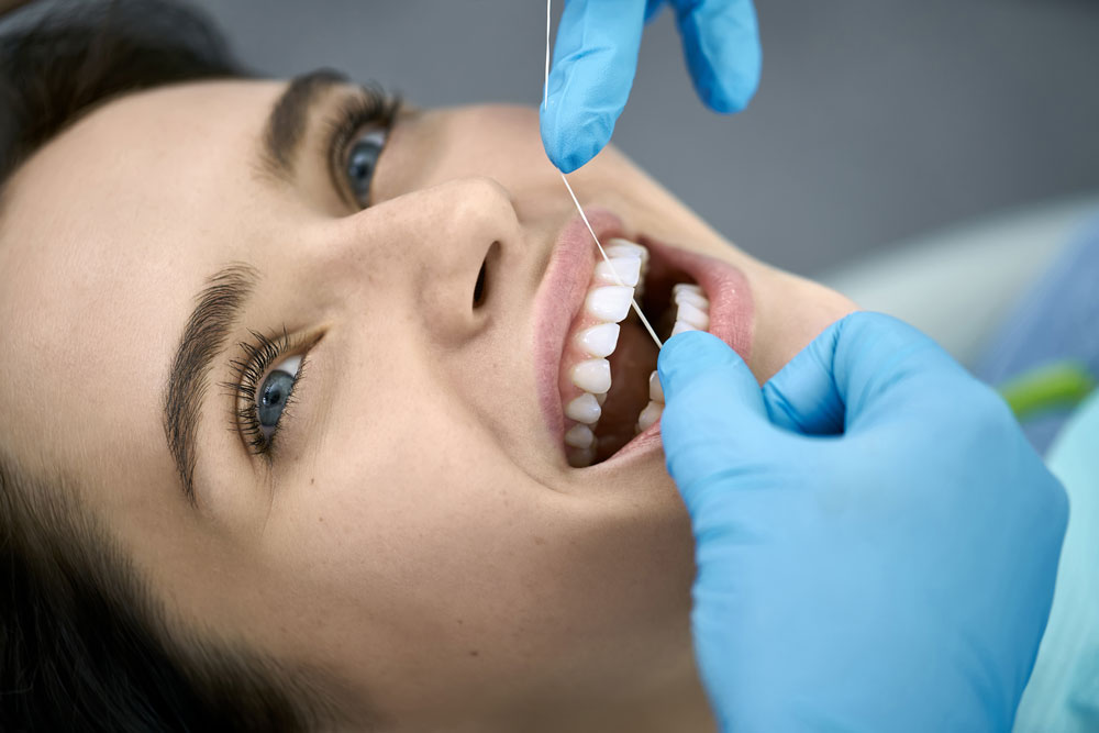 Igiene orale e sbiancamento - Studio Dentistico Loglisci Gattullo
