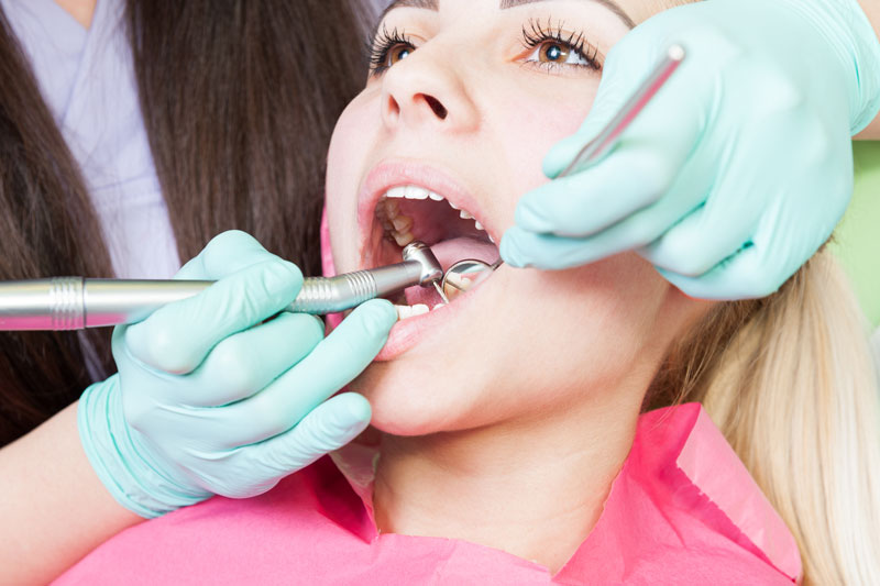 Igiene orale e sbiancamento - Studio Dentistico Loglisci Gattullo
